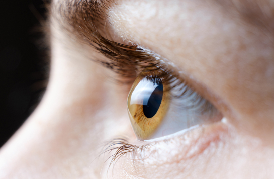 Keratoconus Symptoms